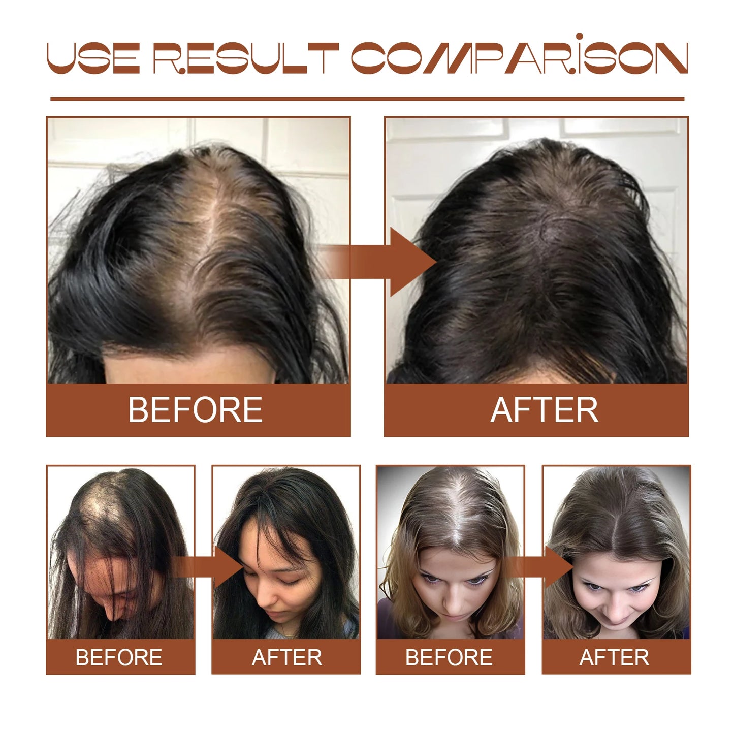 100% Pure Organic Hair Mask Batana Oil Hair Growth Oil Natural Treatment Nourish Reduce Hair Loss Anti-Breakage Hair Conditioner
